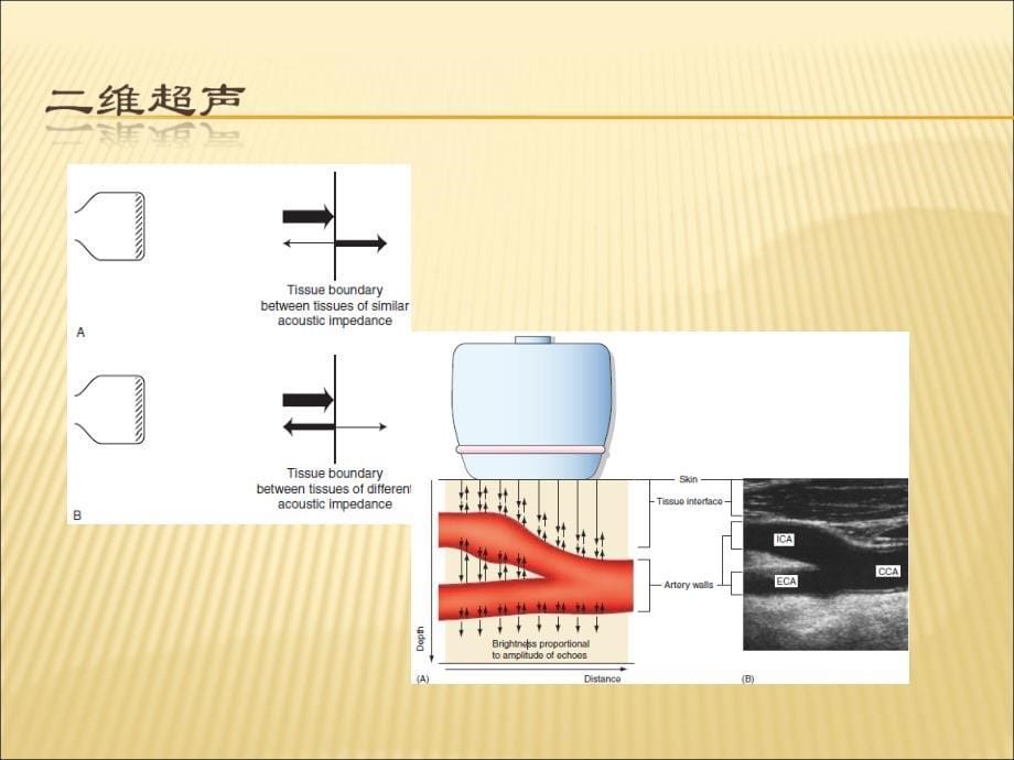 血管超声仪器调节基础_第5页