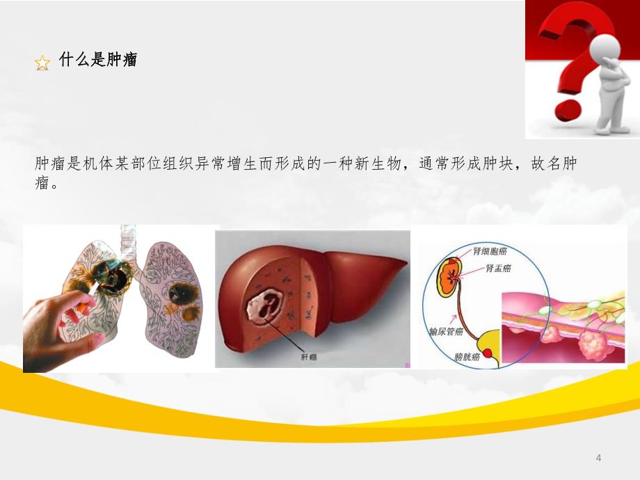 肿瘤患者的中医调补PPT精品文档_第4页