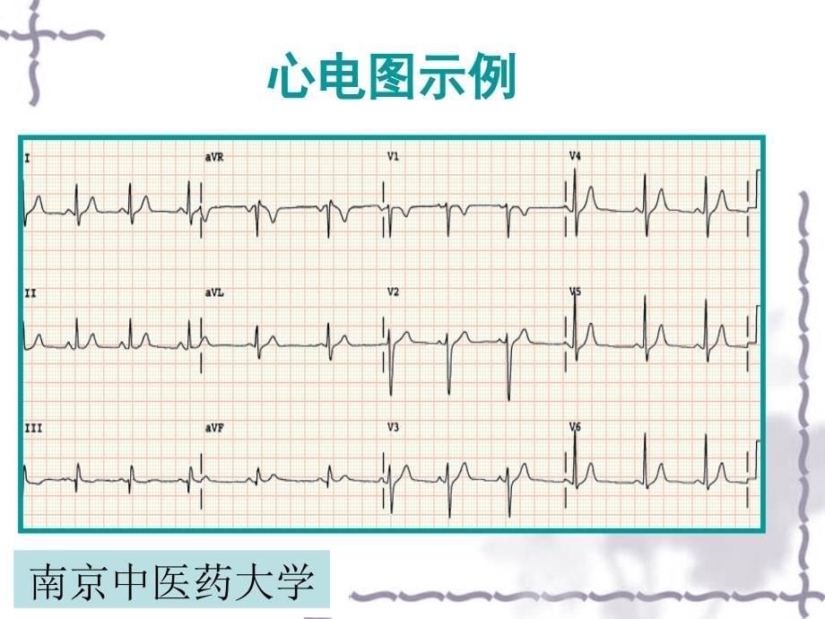 心电图 PPT课件.ppt_第5页