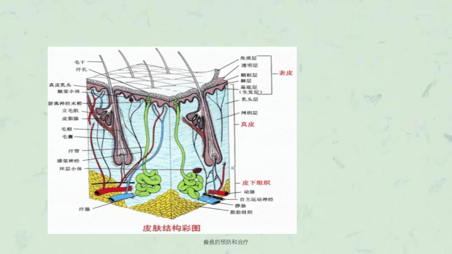 瘢痕的预防和治疗课件_第4页