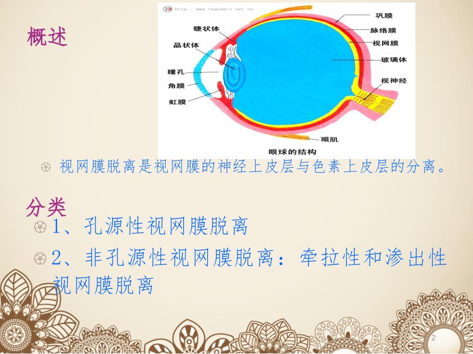 视网膜脱离术后护理.ppt_第2页