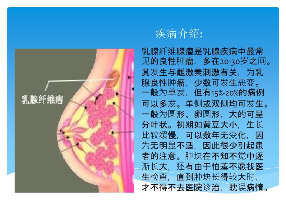 乳腺纤维腺瘤_第2页