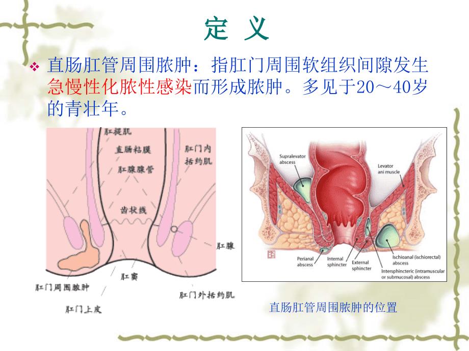 肛周脓肿ppt课件.ppt_第3页