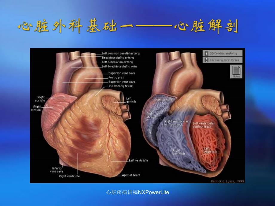 心脏疾病讲稿NXPowerLite课件_第4页