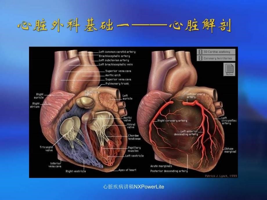 心脏疾病讲稿NXPowerLite课件_第5页