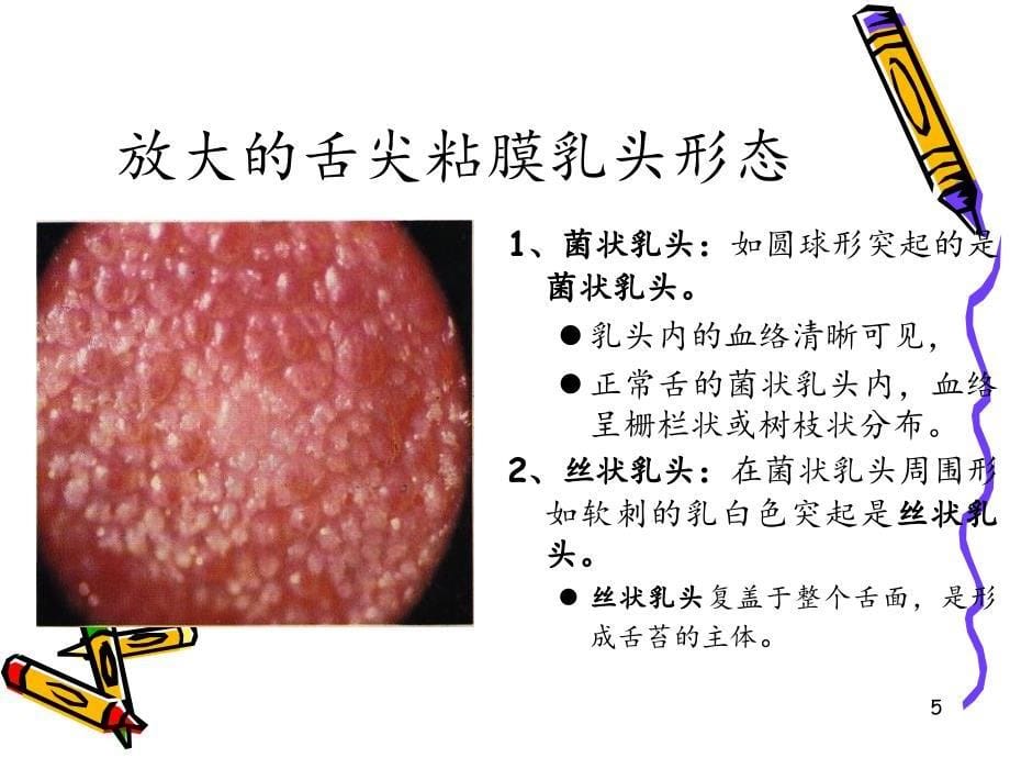 舌质与舌苔变化不一致课件_第5页