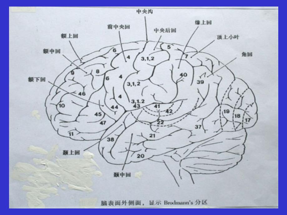 开颅手术切口设计_第3页