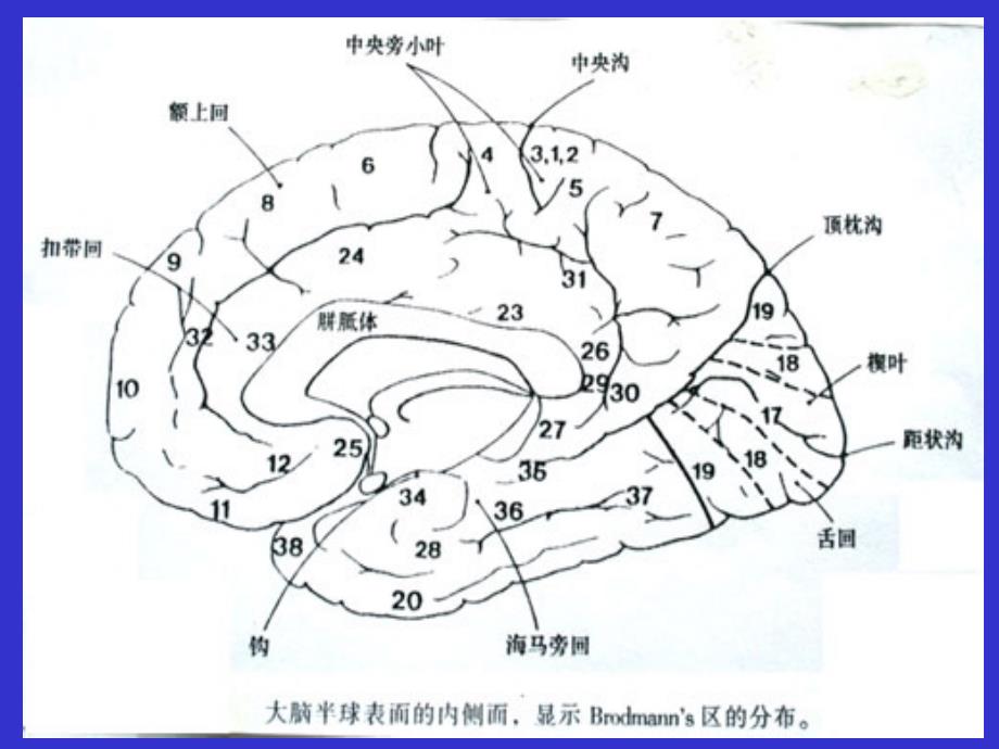 开颅手术切口设计_第4页