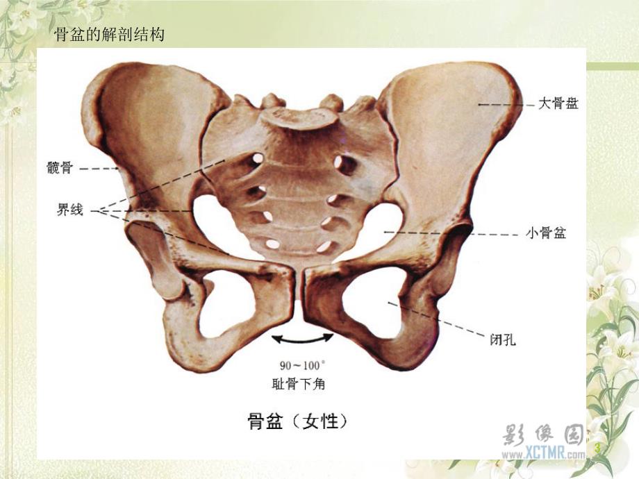 骨盆骨折的并发症护理ppt课件.ppt_第3页