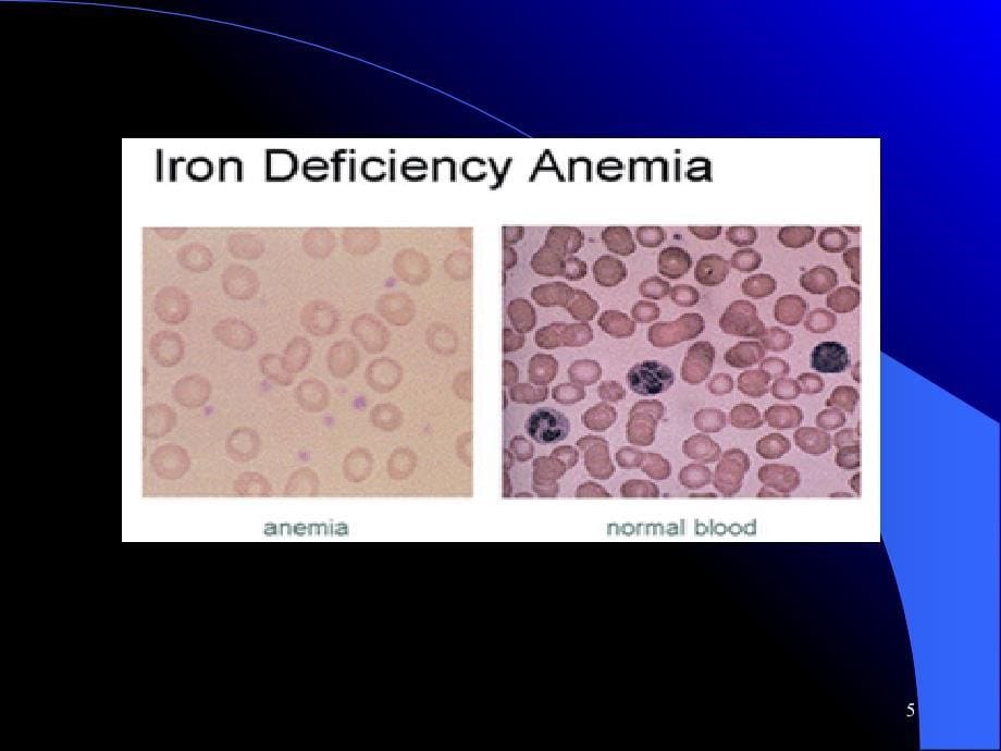 第35章抗贫血药PPT优秀课件_第5页