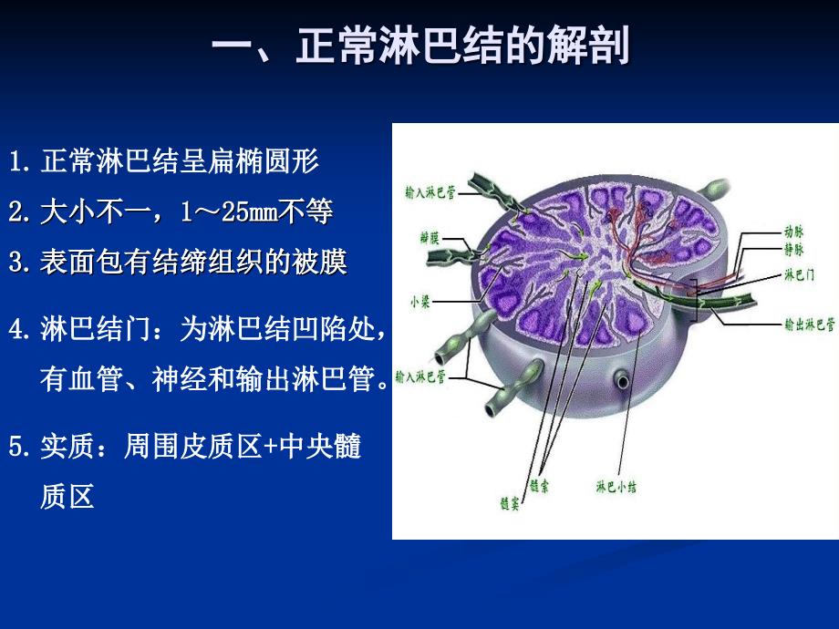 浅表淋巴结超声诊断(1)说课材料_第2页