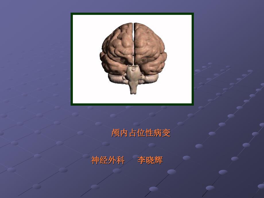 课件：颅内占位.ppt_第1页