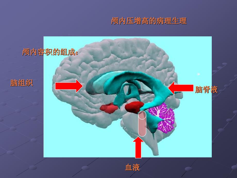 课件：颅内占位.ppt_第4页