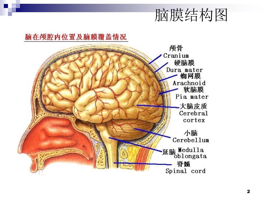 优质医学脑膜瘤的护理查房_第2页