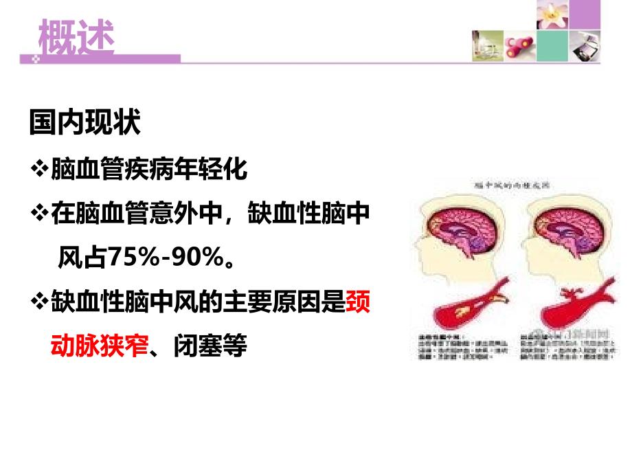 颈动脉内膜剥脱术护理_第3页