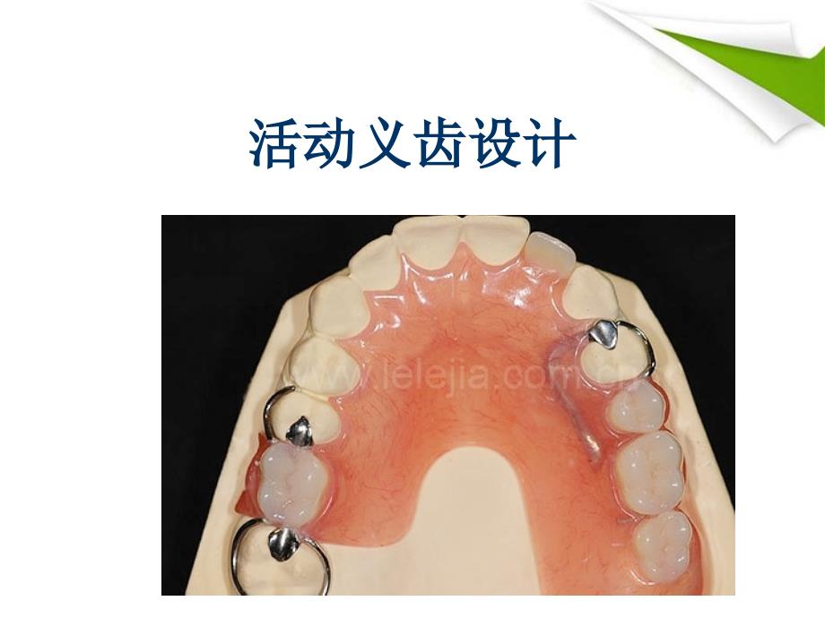 （优质课件）活动义齿设计_第1页