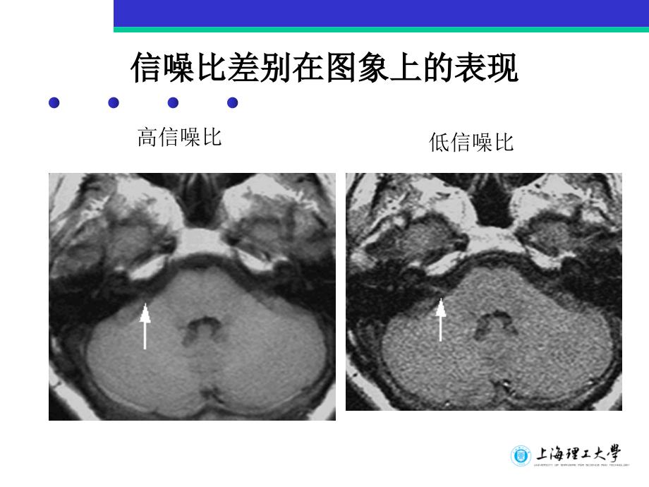 磁共振图象质量参数及其控制课件_第3页