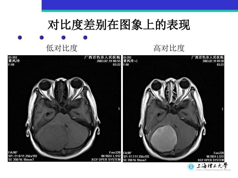 磁共振图象质量参数及其控制课件_第5页