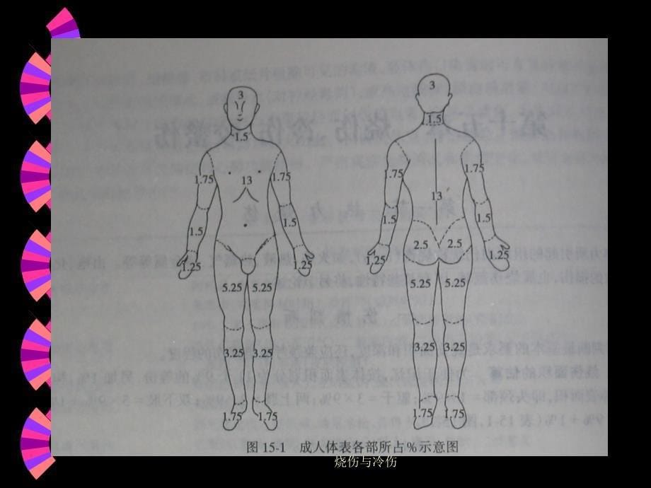 烧伤与冷伤课件_第5页