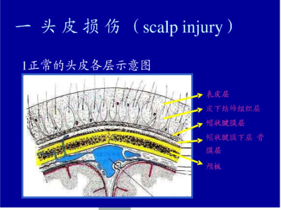 颅脑外伤的救治课件_第3页