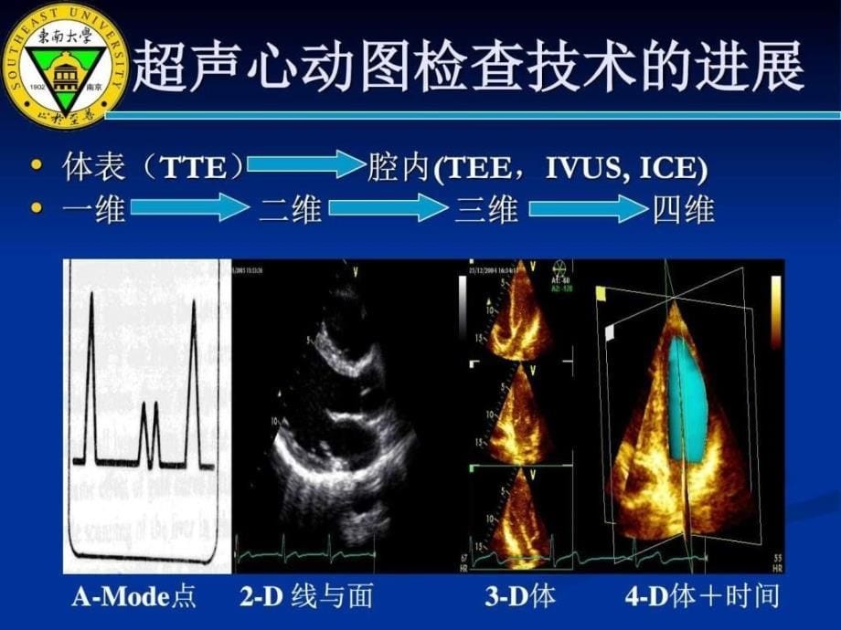 心超声诊断[解剖及正常断面]_第5页