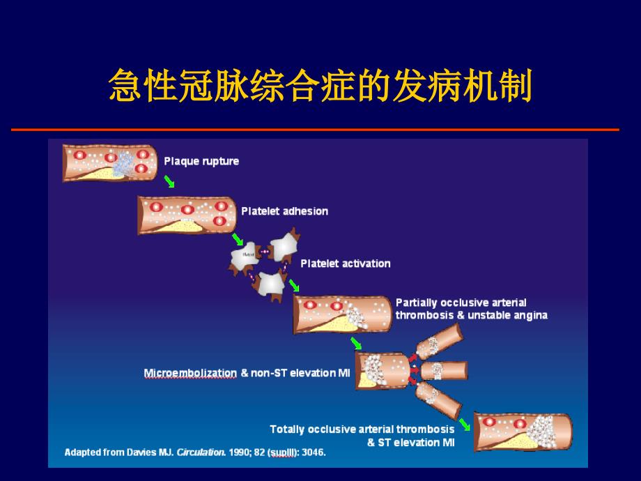 最新急性冠脉综合征的药物治疗PPT文档_第2页