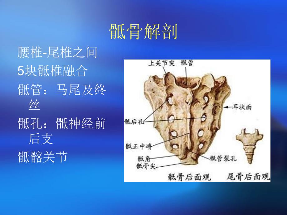 骶骨肿瘤PPT课件_第2页