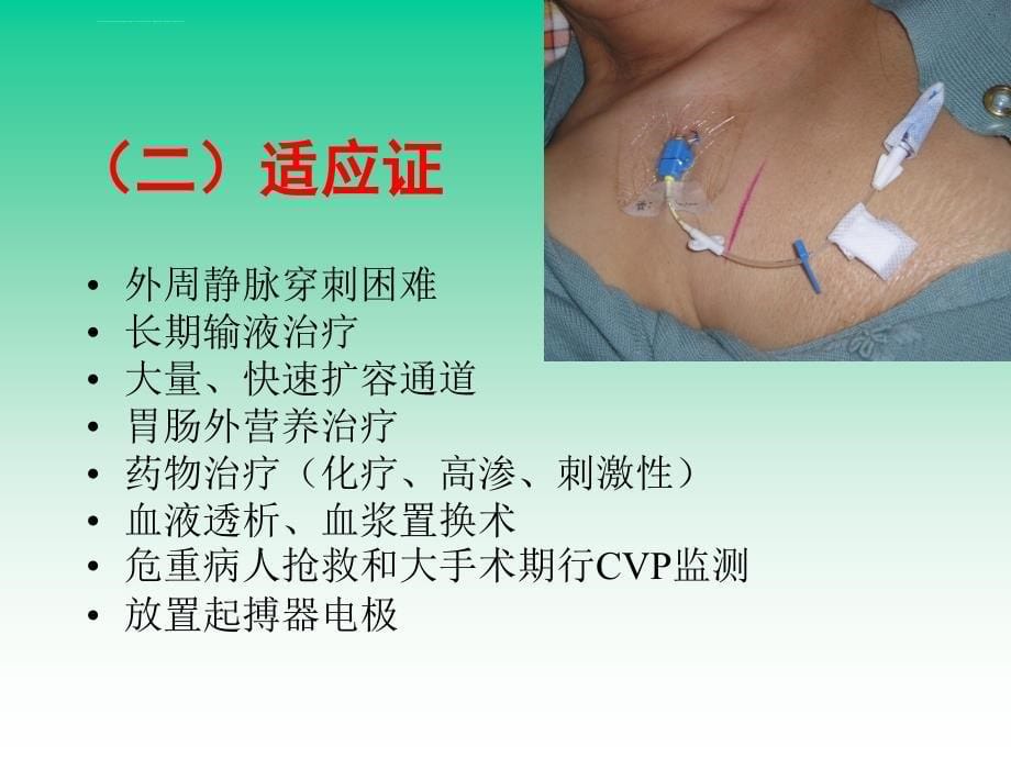 中心静脉穿刺置管术ppt课件_第5页