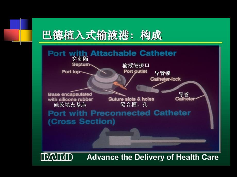 输液港的护理_第4页