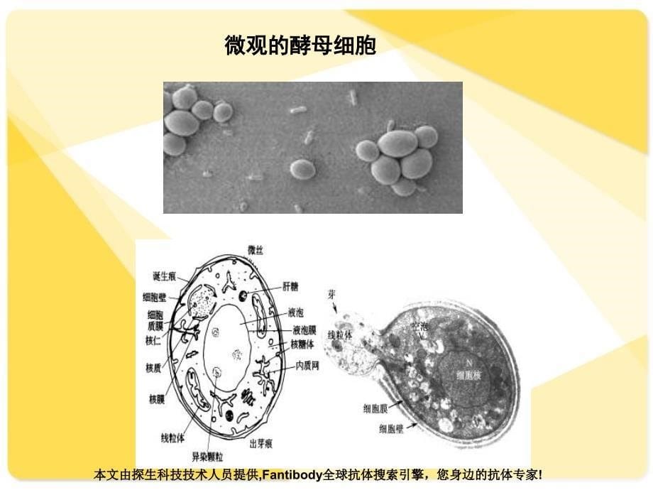 表达产物的SDS聚丙烯酰胺凝胶电泳分离分析鉴定课件_第5页