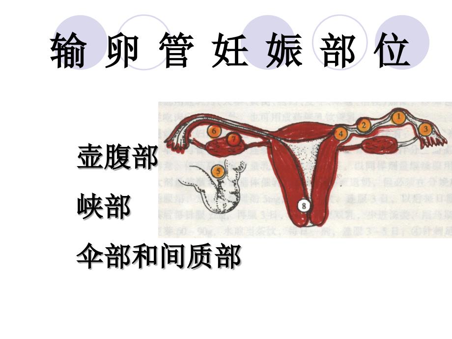 宫外孕、子宫内膜异位症722_第4页