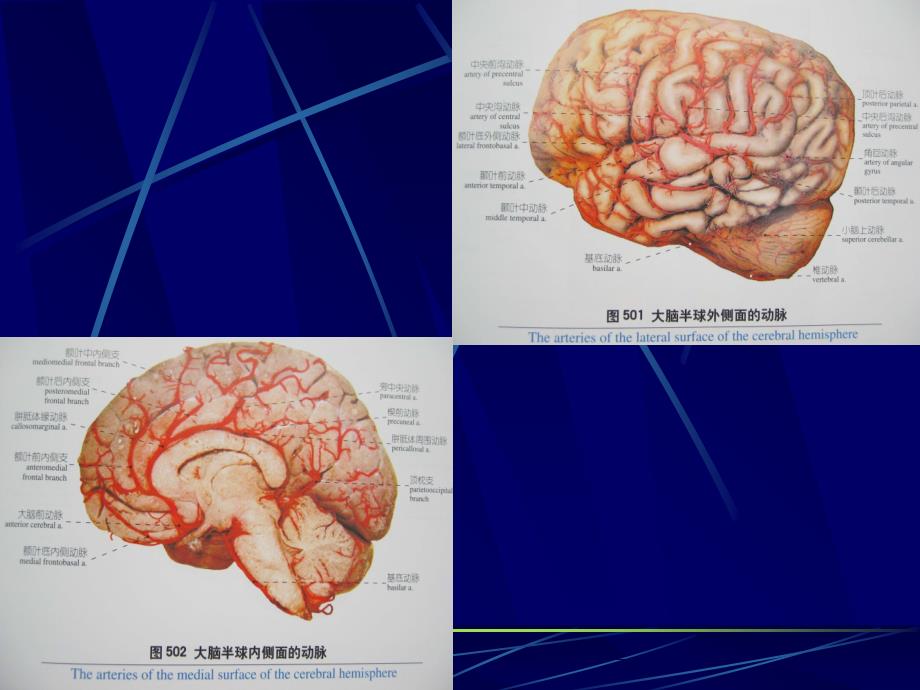 老年性痴呆AD概况PPT课件_第2页