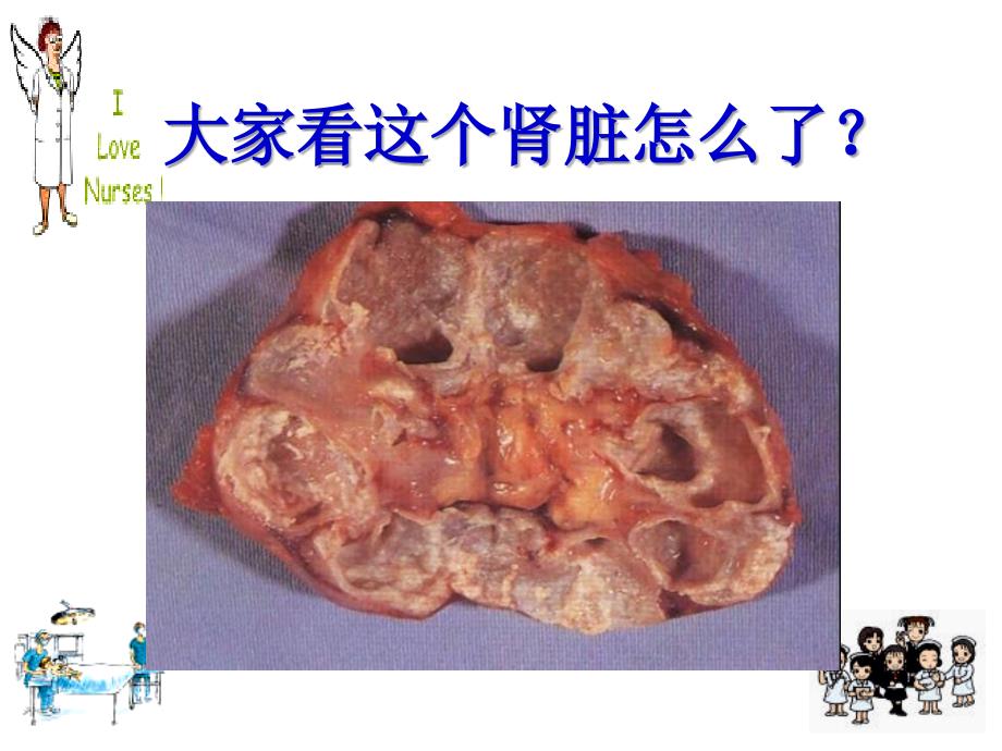 《泌尿系结核护理》PPT课件.ppt_第2页