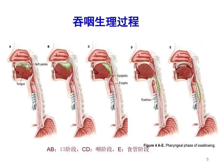 吞咽功能训练_第5页