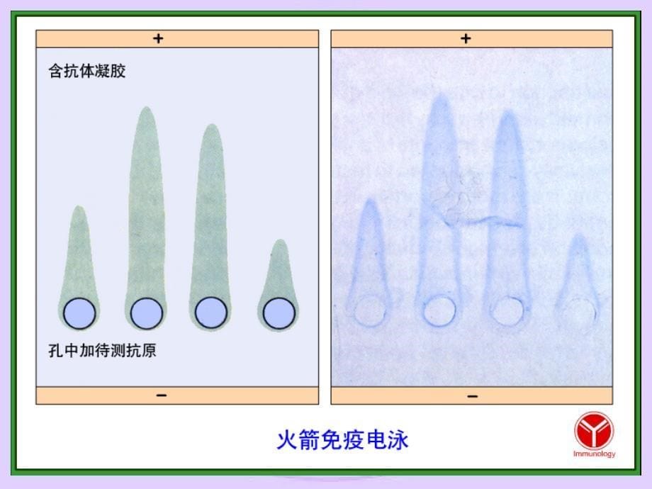 长江大学医学院医学免疫学课件 第二十四章 免疫诊断_第5页