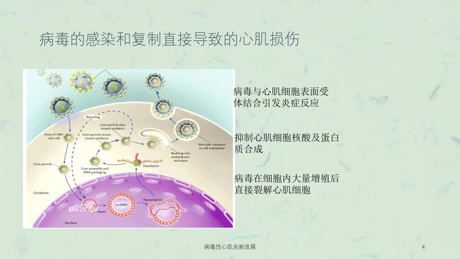 病毒性心肌炎新进展课件_第4页