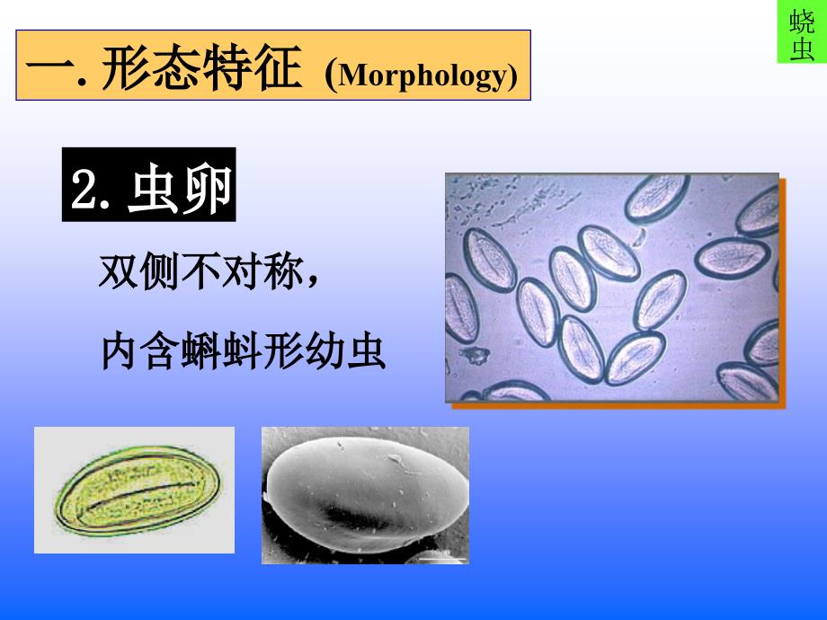 《线虫蛲旋丝》PPT课件.ppt_第4页