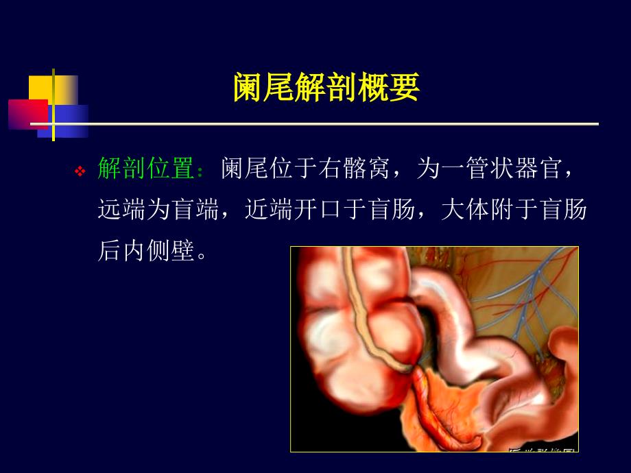 《阑尾炎超声诊断》PPT课件_第3页