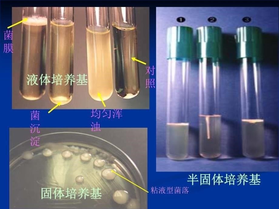 微生物的分类鉴定.ppt_第5页