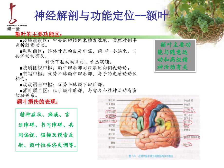 脑血管疾病定位诊断_第4页