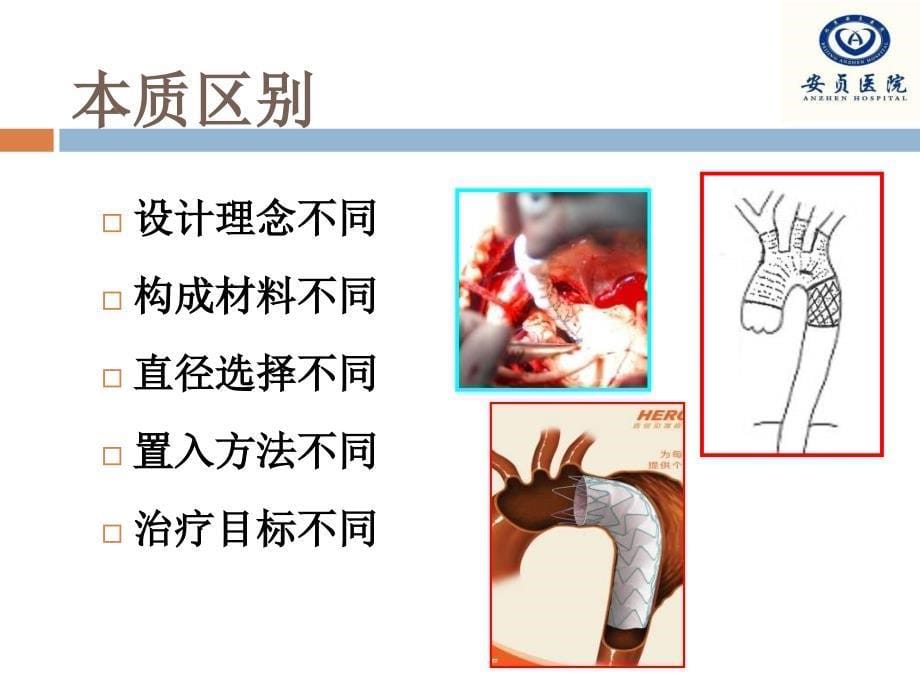 覆膜支架与支架血管的区别_第5页