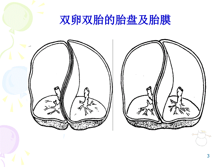 双胎输血综合症_第3页