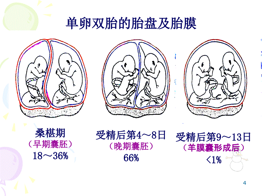 双胎输血综合症_第4页