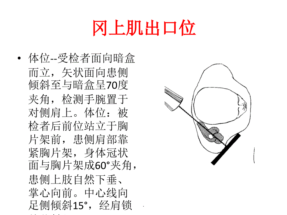岗上肌出口位_第1页