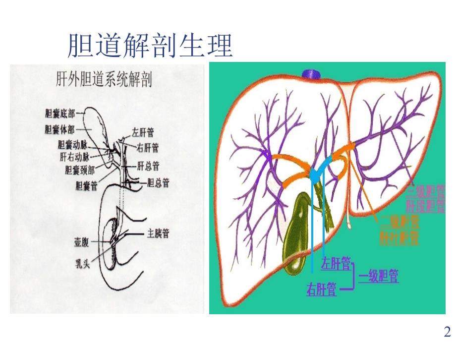 胆囊结石诊疗现状课件_第2页