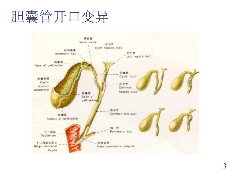 胆囊结石诊疗现状课件_第3页