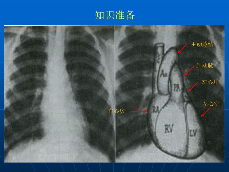 外科学教学资料--心脏疾病_第2页