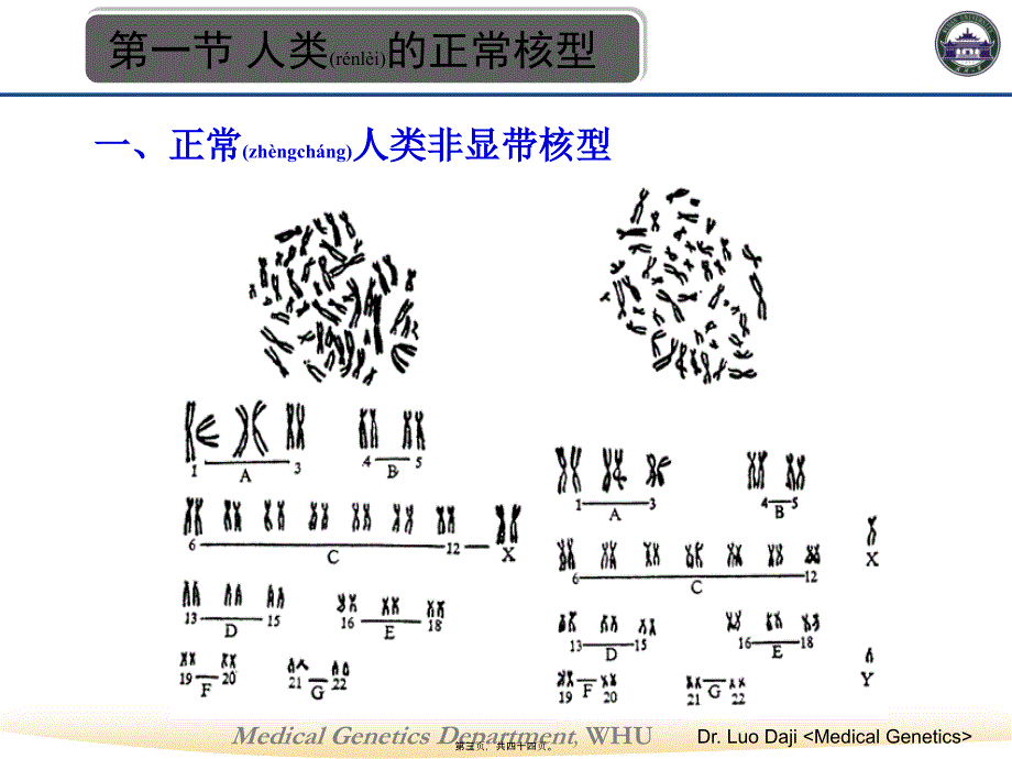 第六节-染色体病课件_第3页