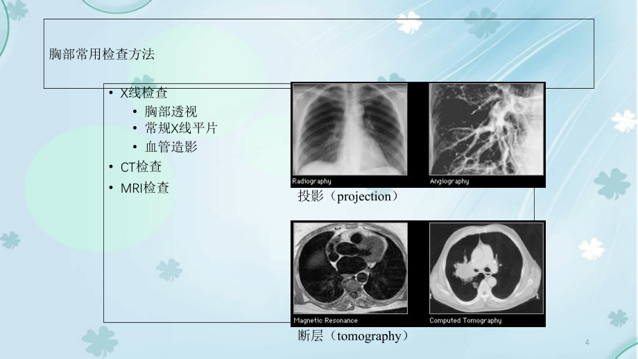 胸部影像解剖干货分享_第4页