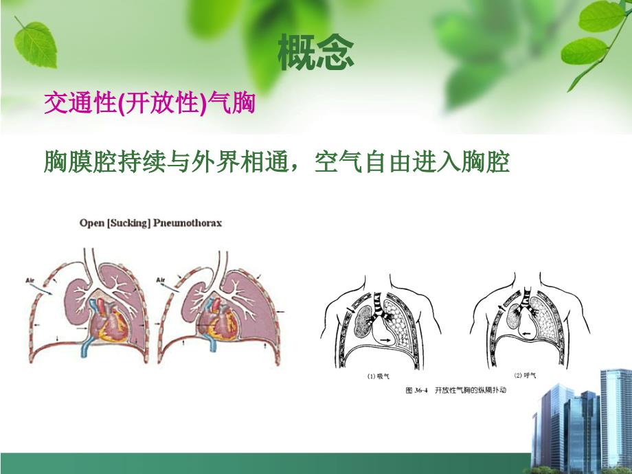 开放性气胸护理ppt_第4页